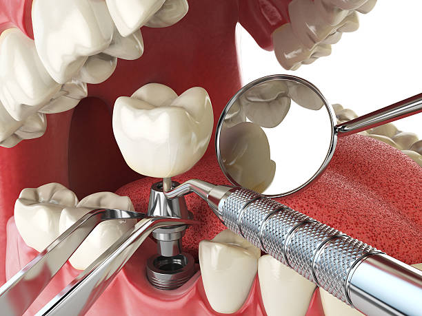 Best Emergency Denture Repair in Hauppauge, NY